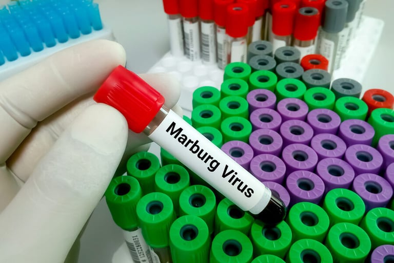 UAE, Saudi, Oman warn against Marburg virus